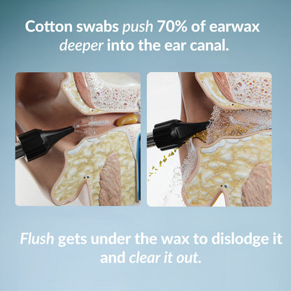 Flush Earwax Remover